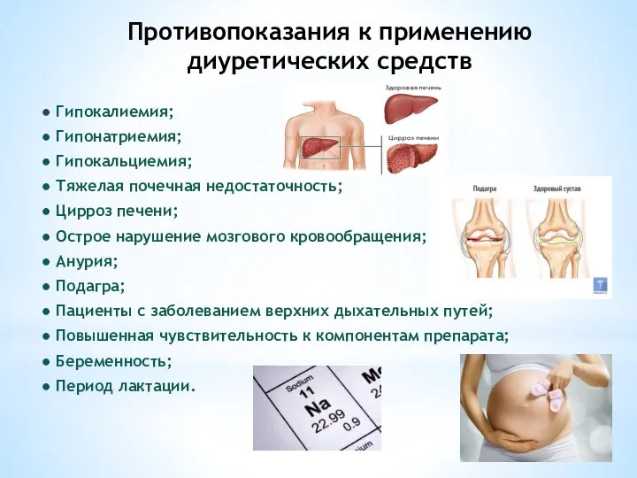 Противопоказания к применению диуретических средств ● Гипокалиемия; ● Гипонатриемия; ● Гипокальциемия;