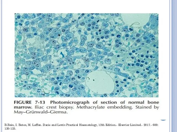 B.Bain, I. Bates, M. Laffan. Dacie and Lewis Practical Haematology, 12th