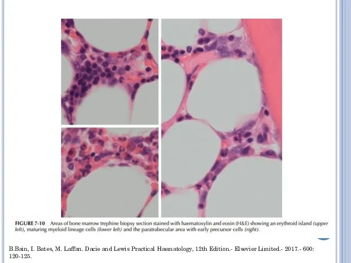 B.Bain, I. Bates, M. Laffan. Dacie and Lewis Practical Haematology, 12th