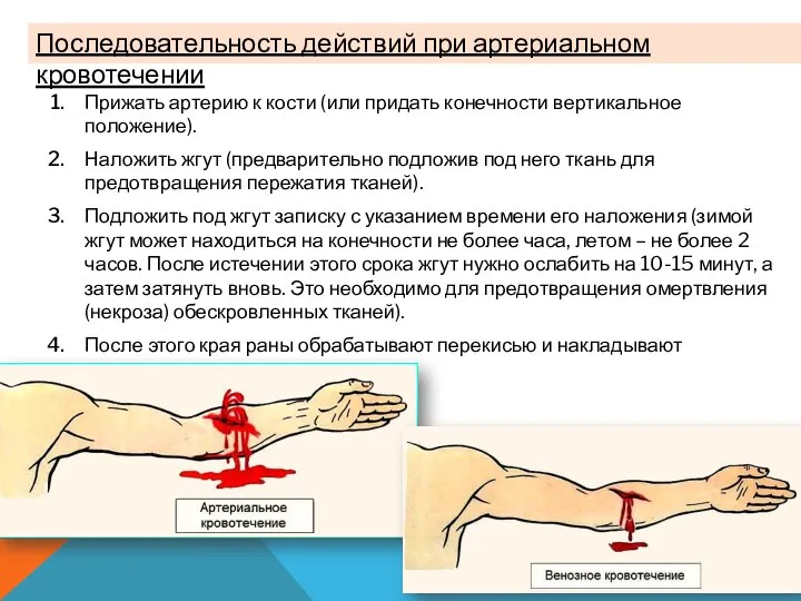 Прижать артерию к кости (или придать конечности вертикальное положение). Наложить жгут