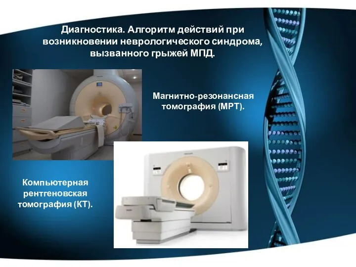 Диагностика. Алгоритм действий при возникновении неврологического синдрома, вызванного грыжей МПД. Магнитно-резонансная