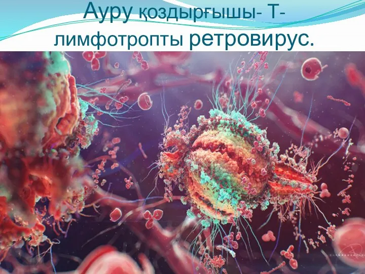 Ауру қоздырғышы- Т-лимфотропты ретровирус. Ауру қоздырғышы-Т-лимфотропты ретровирус.