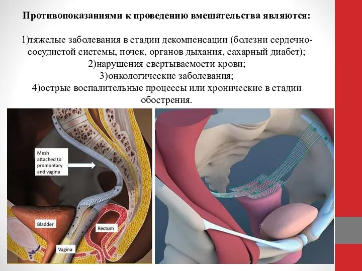 Противопоказаниями к проведению вмешательства являются: 1)тяжелые заболевания в стадии декомпенсации (болезни