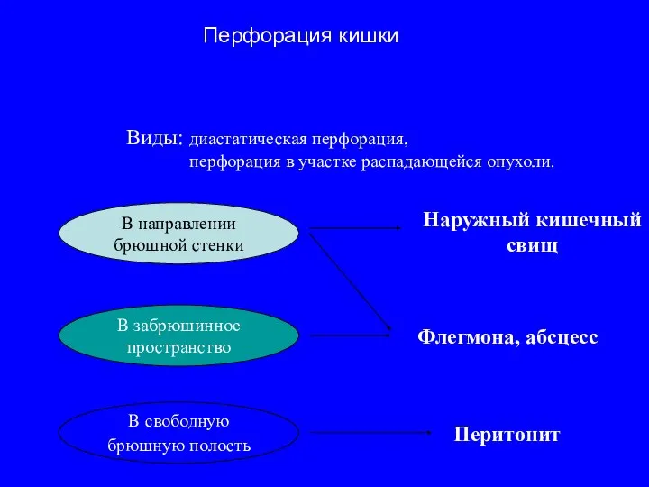 Виды: диастатическая перфорация, перфорация в участке распадающейся опухоли. В направлении брюшной