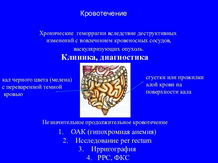 Клиника, диагностика Хронические геморрагии вследствие деструктивных изменений с вовлечением кровеносных сосудов,