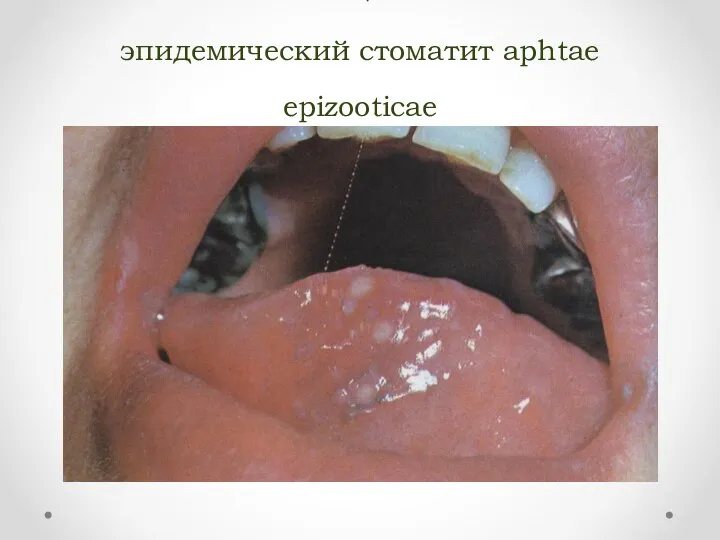 ЯЩУР эпидемический стоматит aphtae epizooticae