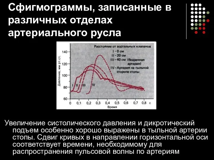 Сфигмограммы, записанные в различных отделах артериального русла Увеличение систолического давления и