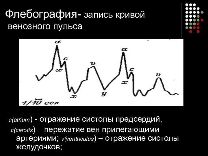 Флебография- запись кривой венозного пульса a(atrium) - отражение систолы предсердий, c(carotis)