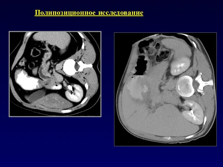 Полипозиционное исследование