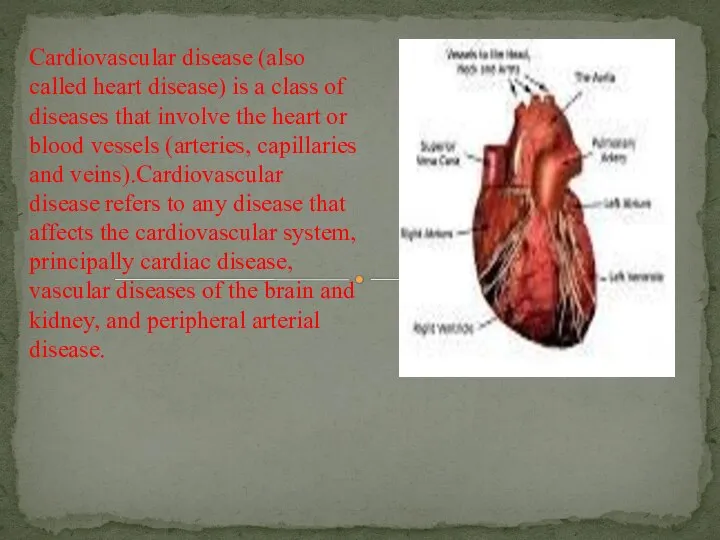 Cardiovascular disease (also called heart disease) is a class of diseases
