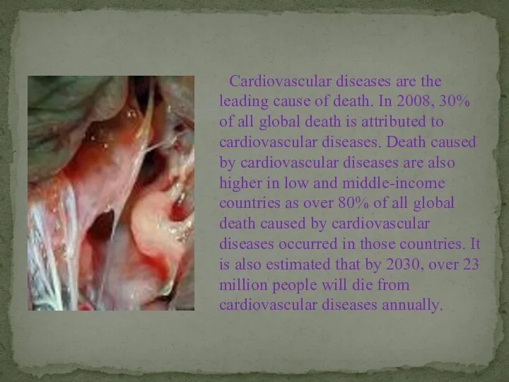 Cardiovascular diseases are the leading cause of death. In 2008, 30%