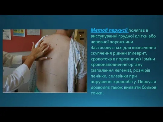 Метод перкусії полягає в вистукуванні грудної клітки або черевної порожнини. Застосовується