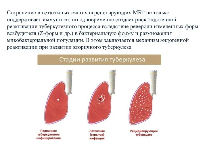 Сохранение в остаточных очагах персистирующих МБТ не только поддерживает иммунитет, но