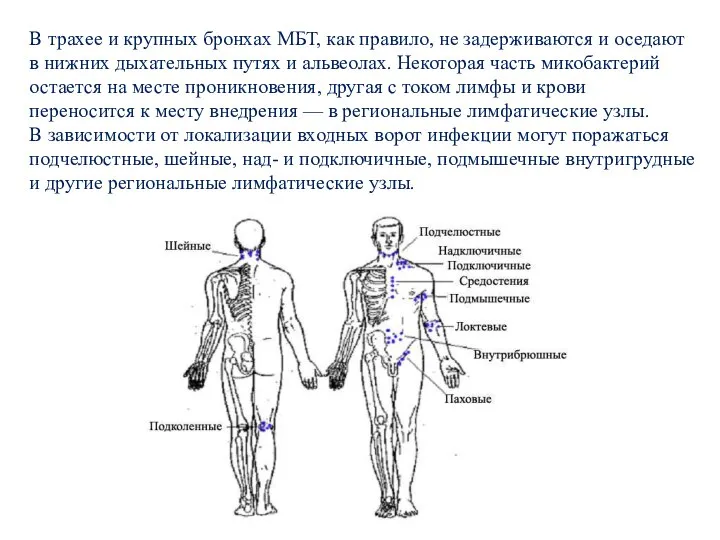 В трахее и крупных бронхах МБТ, как правило, не задерживаются и