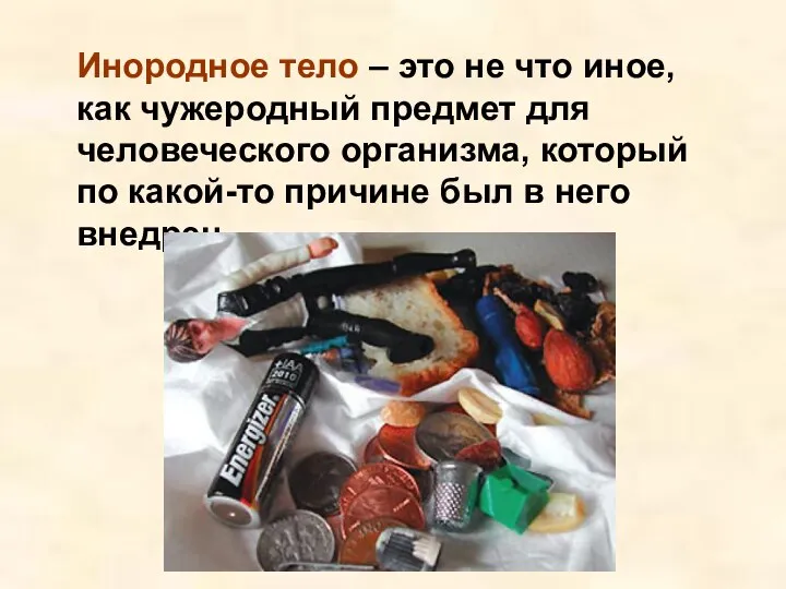 Инородное тело – это не что иное, как чужеродный предмет для