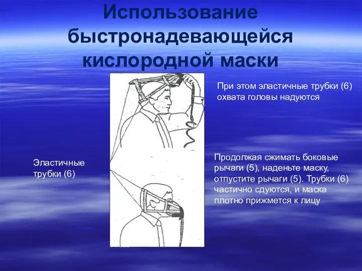 Использование быстронадевающейся кислородной маски При этом эластичные трубки (6) охвата головы