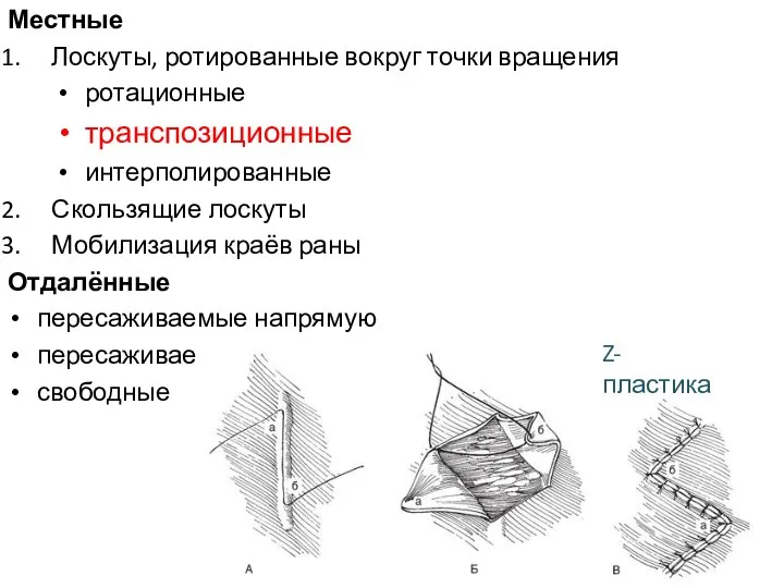 Местные Лоскуты, ротированные вокруг точки вращения ротационные транспозиционные интерполированные Скользящие лоскуты