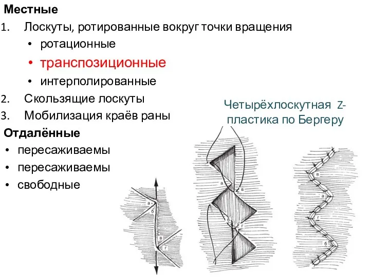 Местные Лоскуты, ротированные вокруг точки вращения ротационные транспозиционные интерполированные Скользящие лоскуты