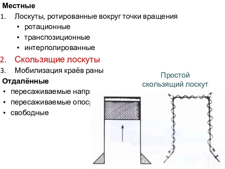 Местные Лоскуты, ротированные вокруг точки вращения ротационные транспозиционные интерполированные Скользящие лоскуты