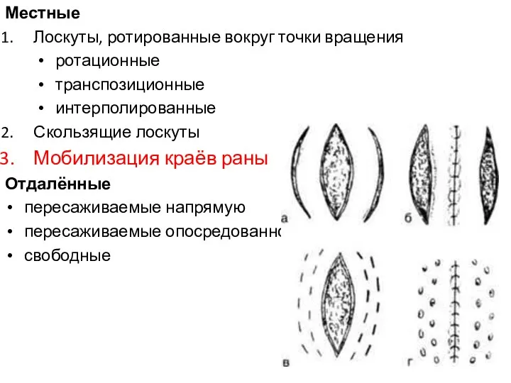 Местные Лоскуты, ротированные вокруг точки вращения ротационные транспозиционные интерполированные Скользящие лоскуты