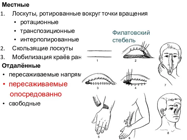 Местные Лоскуты, ротированные вокруг точки вращения ротационные транспозиционные интерполированные Скользящие лоскуты