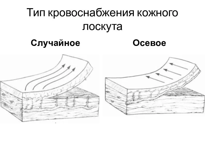 Тип кровоснабжения кожного лоскута Случайное Осевое