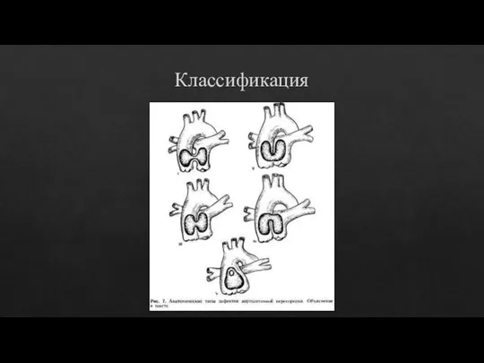 Классификация