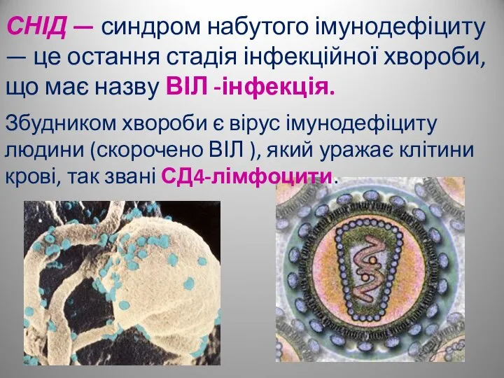 СНІД — синдром набутого імунодефіциту — це остання стадія інфекційної хвороби,