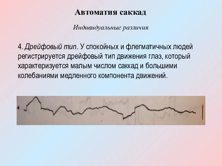 4. Дрейфовый тип. У спокойных и флегматичных людей регистрируется дрейфовый тип