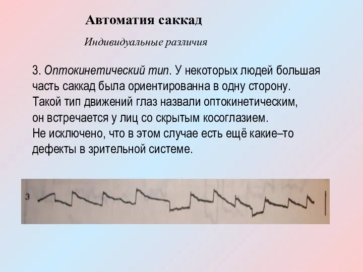 3. Оптокинетический тип. У некоторых людей большая часть саккад была ориентированна