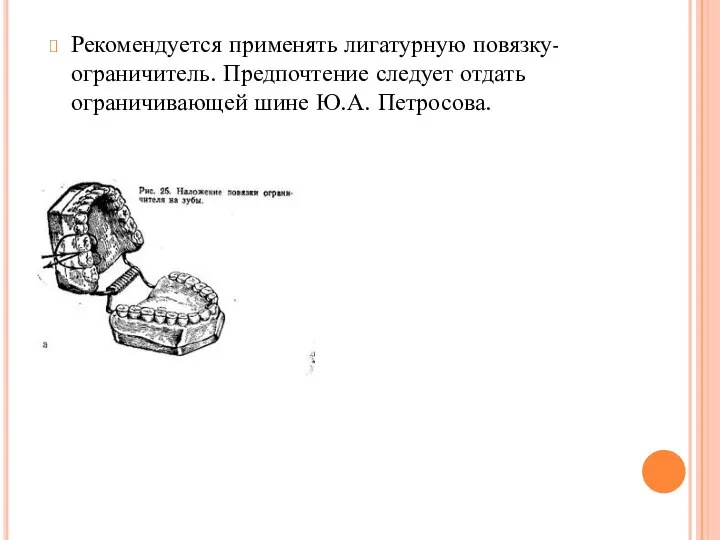 Рекомендуется применять лигатурную повязку-ограничитель. Предпочтение следует отдать ограничивающей шине Ю.А. Петросова.