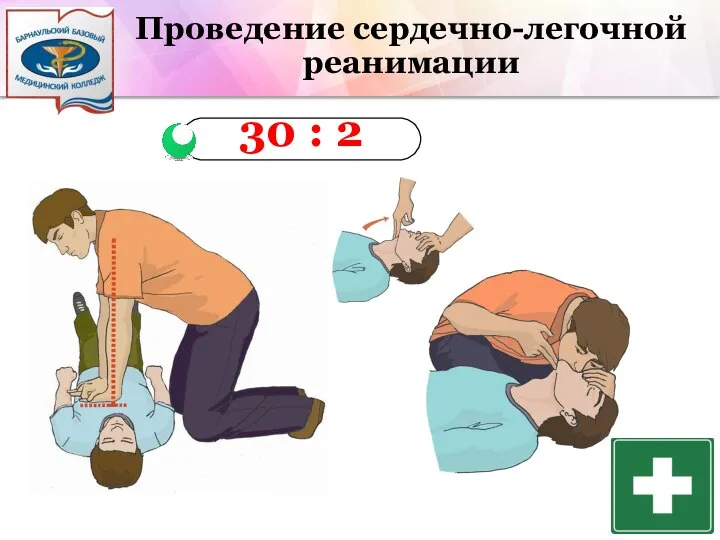 Проведение сердечно-легочной реанимации