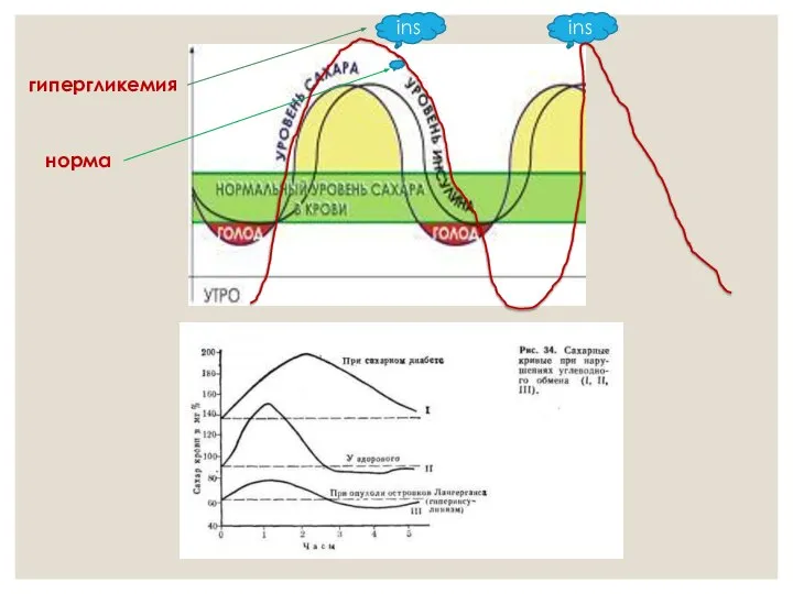 ins ins норма гипергликемия