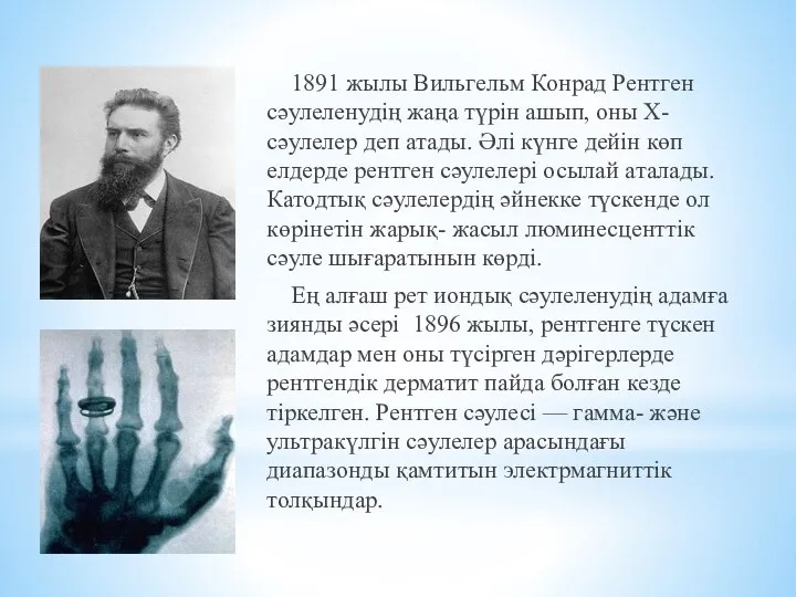 1891 жылы Вильгельм Конрад Рентген сәулеленудің жаңа түрін ашып, оны Х-сәулелер