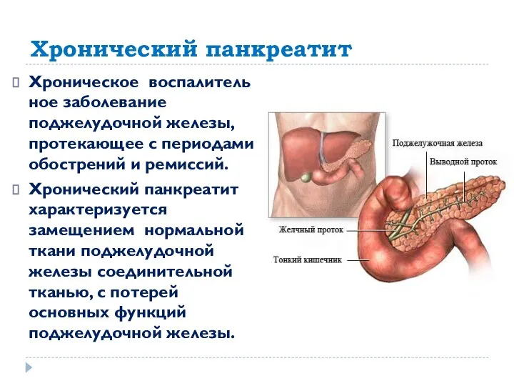 Хронический панкреатит Хроническое воспалительное заболевание поджелудочной железы, протекающее с периодами обострений