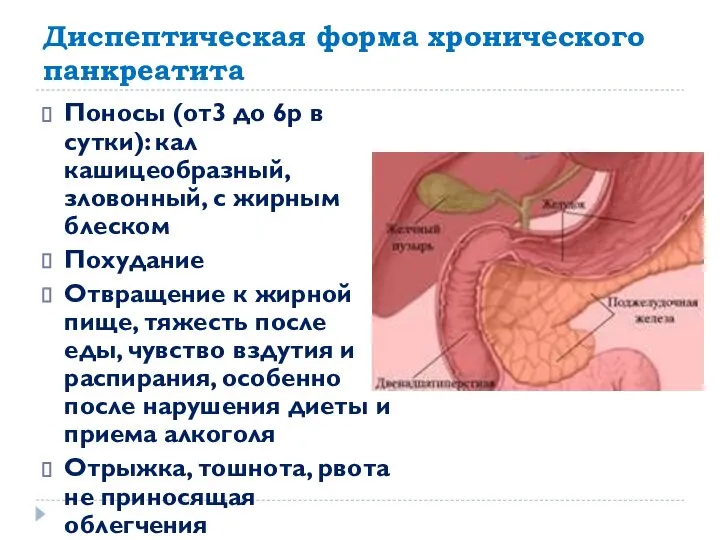 Диспептическая форма хронического панкреатита Поносы (от3 до 6р в сутки): кал