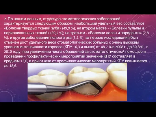 2. По нашим данным, структура стоматологических заболеваний характеризуется следующим образом: наибольший