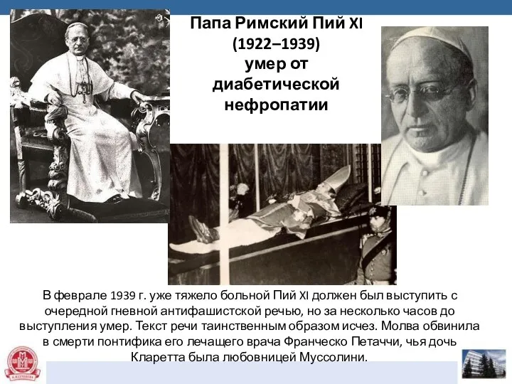 Папа Римский Пий XI (1922–1939) умер от диабетической нефропатии В феврале
