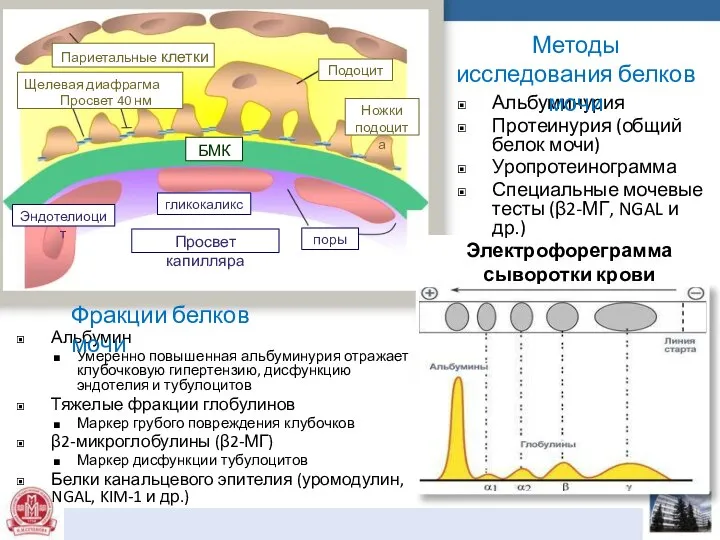 Электрофореграмма сыворотки крови