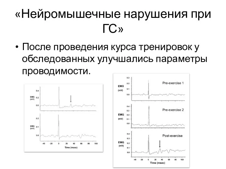 После проведения курса тренировок у обследованных улучшались параметры проводимости. «Нейромышечные нарушения при ГС»