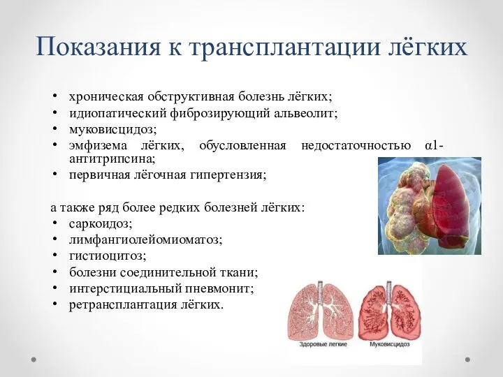 Показания к трансплантации лёгких хроническая обструктивная болезнь лёгких; идиопатический фиброзирующий альвеолит;