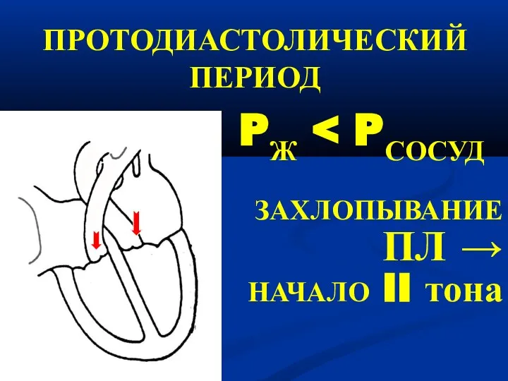 ПРОТОДИАСТОЛИЧЕСКИЙ ПЕРИОД PЖ ЗАХЛОПЫВАНИЕ ПЛ → НАЧАЛО II тона