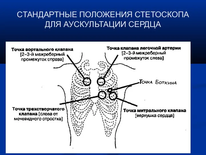 СТАНДАРТНЫЕ ПОЛОЖЕНИЯ СТЕТОСКОПА ДЛЯ АУСКУЛЬТАЦИИ СЕРДЦА