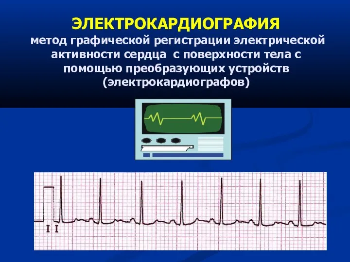 ЭЛЕКТРОКАРДИОГРАФИЯ метод графической регистрации электрической активности сердца с поверхности тела с помощью преобразующих устройств (электрокардиографов)