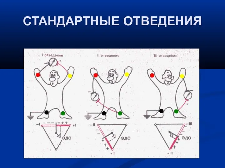 СТАНДАРТНЫЕ ОТВЕДЕНИЯ