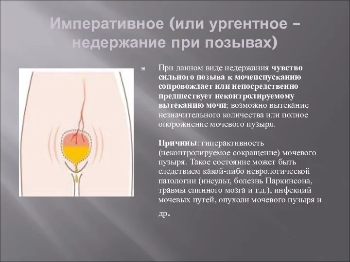 Императивное (или ургентное – недержание при позывах) При данном виде недержания