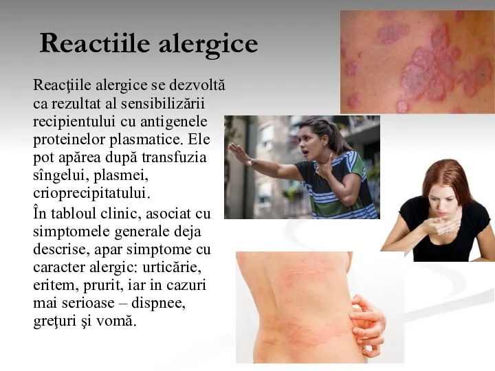 Reactiile alergice Reacţiile alergice se dezvoltă ca rezultat al sensibilizării recipientului