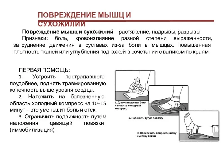 ПОВРЕЖДЕНИЕ МЫШЦ И СУХОЖИЛИЙ Повреждение мышц и сухожилий – растяжение, надрывы,