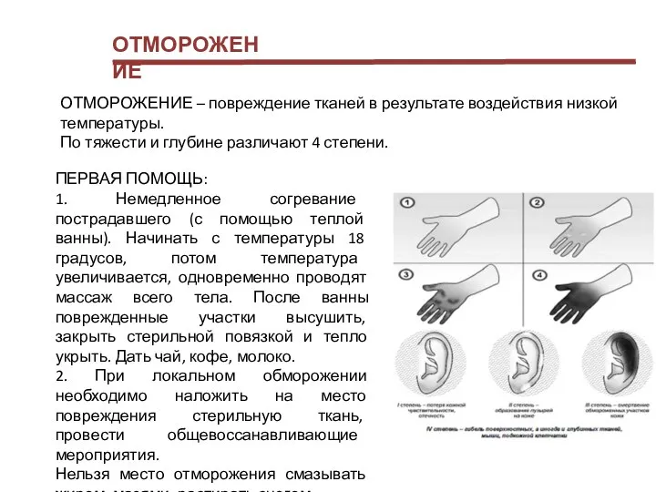 ОТМОРОЖЕНИЕ ОТМОРОЖЕНИЕ – повреждение тканей в результате воздействия низкой температуры. По