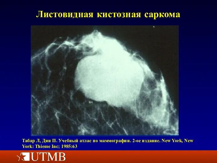 Листовидная кистозная саркома Табар Л, Дин П. Учебный атлас по маммографии.